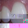 dents.jpg