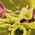 Salmonella