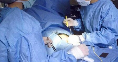 Chirurgie