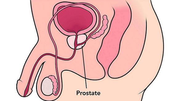 Prostate (plan de coupe)