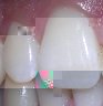 dents.jpg